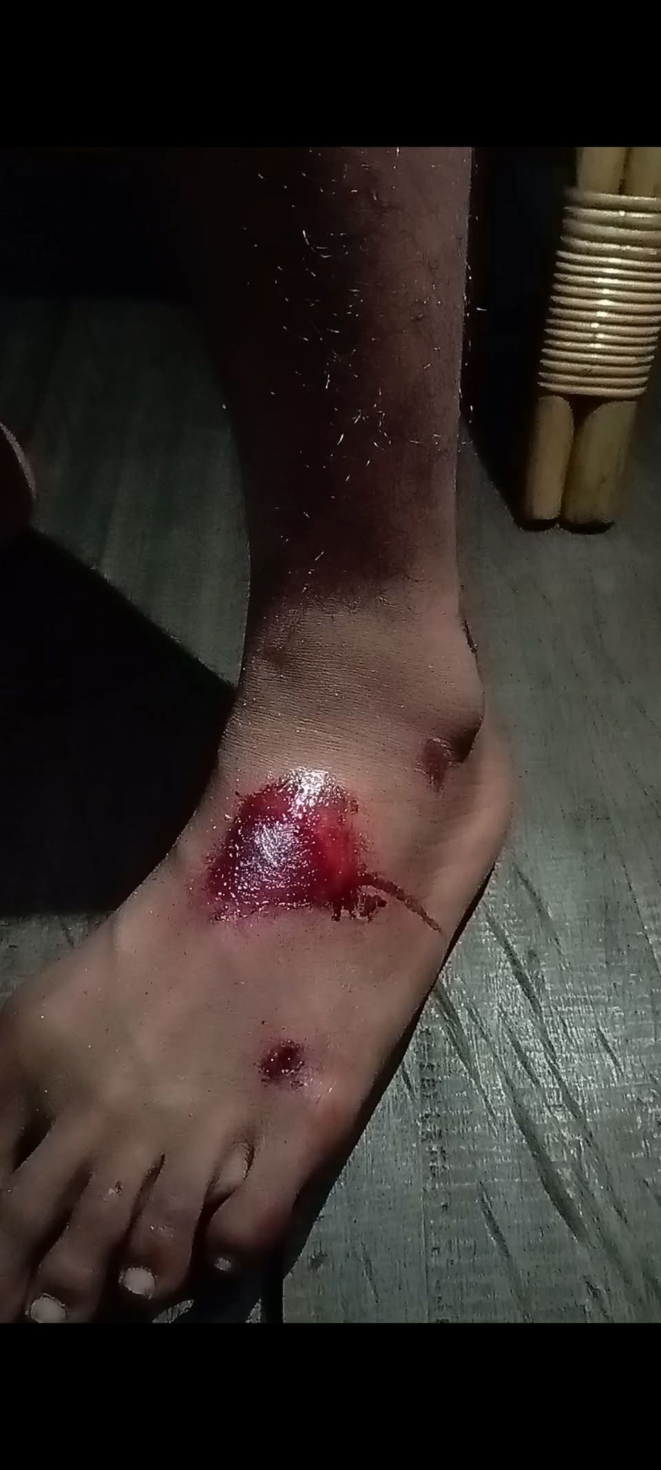 Tumpukan sampah di bahu jalan Kompleks Perumahan 200, Waisai, yang dikeluhkan warga karena membahayakan pengguna jalan dan menarik hewan liar.